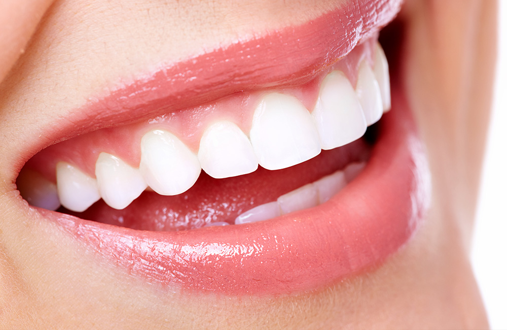 Smile design, Studio Dentistico Dott. Luca Lancieri. Specialista in odontostomatologia, protesi dentale, implantologia e parodontologia, Genova