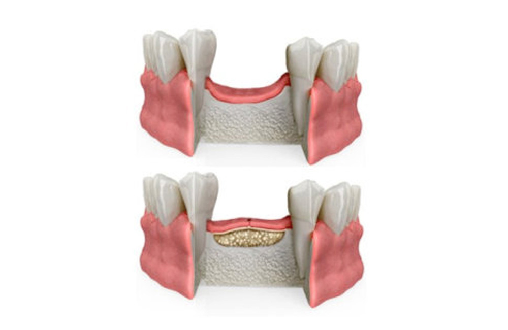 ROC, Studio Dentistico Dott. Luca Lancieri. Specialista in odontostomatologia, protesi dentale, implantologia e parodontologia, Genova