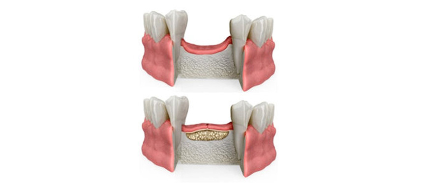 ROC, Studio Dentistico Dott. Luca Lancieri. Specialista in odontostomatologia, protesi dentale, implantologia e parodontologia, Genova