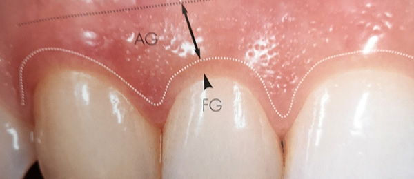 Studio Dentistico Dott. Luca Lancieri. Specialista in odontostomatologia, protesi dentale, implantologia e parodontologia, Genova